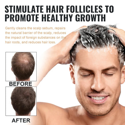 Shampoing Traitement Chute Cheveux Favorise la Croissance Renforce les Racines Répare le Cuir Chevelu Anti-Chute Hydratant Épaississant Soin Capillaire