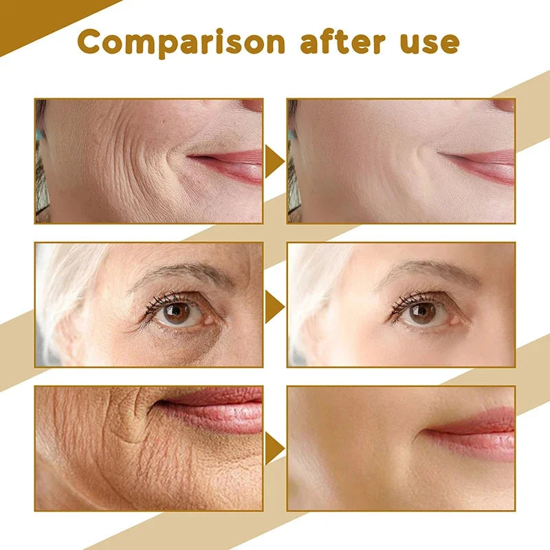 Sérum Visage Centella Asiatica Nourrit Peau Sèche Lissant Rajeunissant Éclaircissant Hydratant Visage Coréen