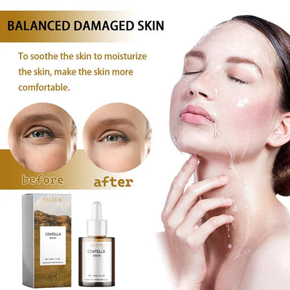 Sérum Visage Centella Asiatica Nourrit Peau Sèche Lissant Rajeunissant Éclaircissant Hydratant Visage Coréen