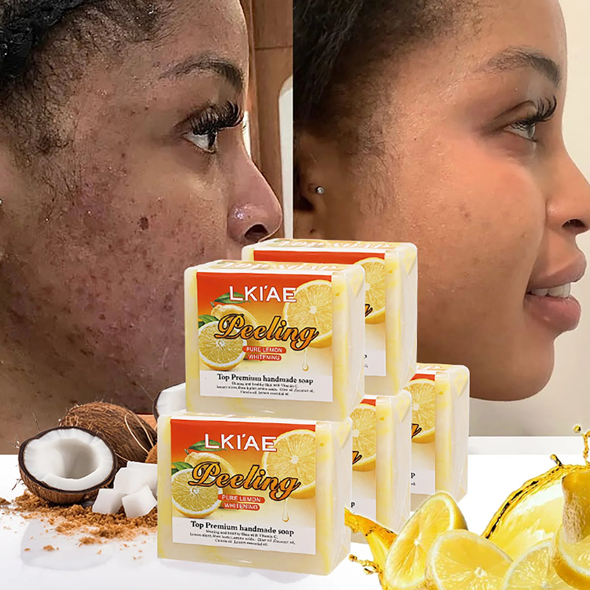 LKIAE Savon Éclaircissant au Citron Pur Naturel, Nettoyant Visage et Corps, Contrôle du Sébum, Élimine l'Acné, les Taches Brunes, les Points Noirs, 150g