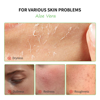 Coffret de Soins Multi-peaux à l'Aloès - Hydratation Profonde, Nutrition Intense, Éclaircissant, Hydratant, Lisse la Peau